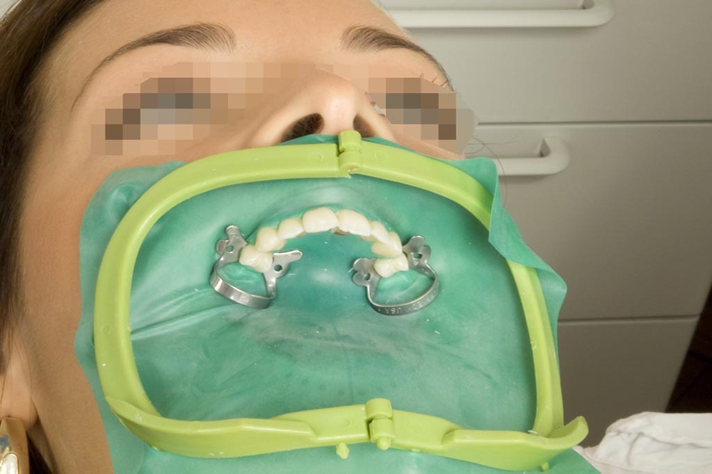 رعایت استانداردهای بین المللی درمان ریشه 