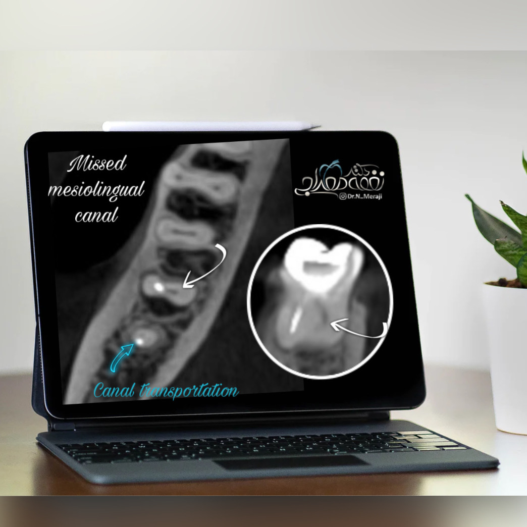 ارزیابی دقیق قبل از درمان