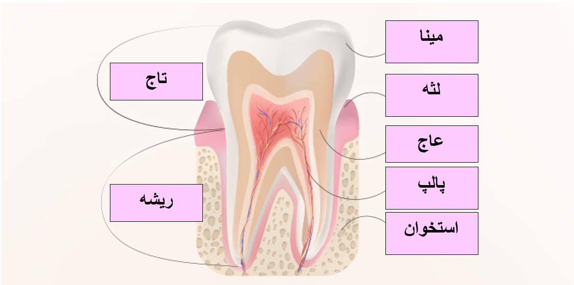 درمان ریشه دندان