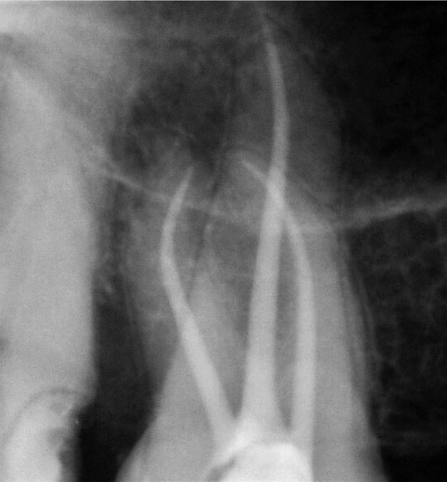 درمان ریشه تخصصی