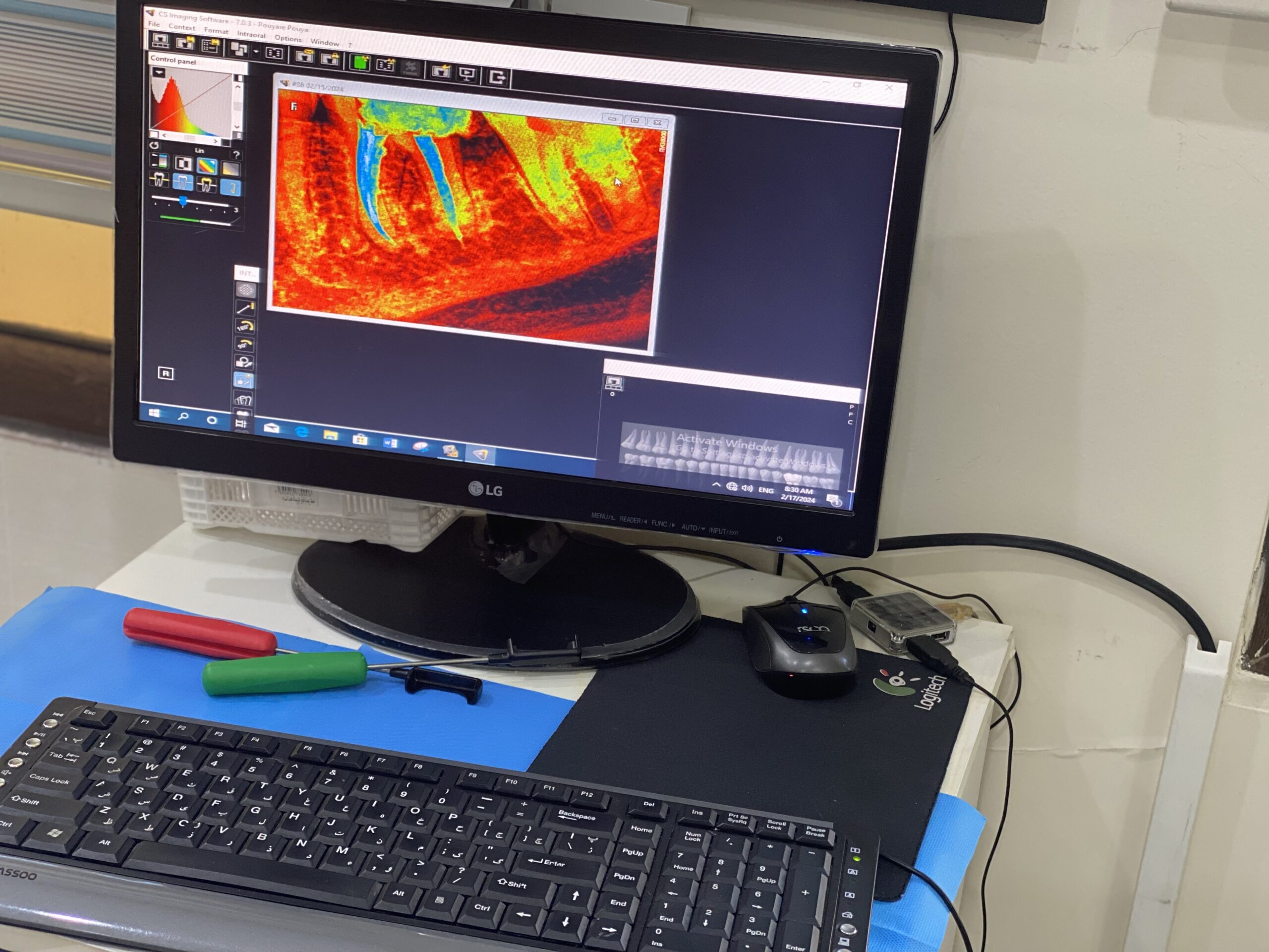 استفاده از تکنولوژی های نوین از جمله رادیوگرافی دیجیتال